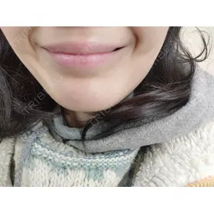 池袋美容クリニック 池袋美容クリニック口コミ