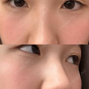 TCB東京中央美容外科 TCB東京中央美容外科 渋谷西口院口コミ