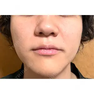 アイネクリニック アイネクリニック　川崎院口コミ