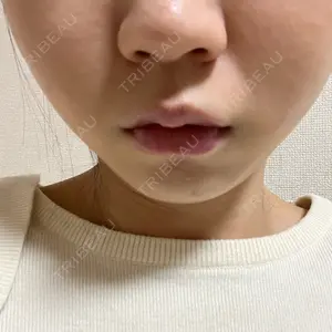 やさしい美容皮膚科・皮フ科 やさしい美容皮膚科・皮フ科　秋葉原院口コミ
