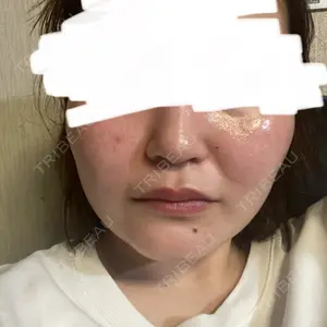 TCB東京中央美容外科 TCB東京中央美容外科 岡山院口コミ