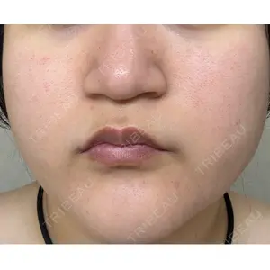 東京美容皮膚科アロエクリニック 東京美容皮膚科アロエクリニック池袋口コミ