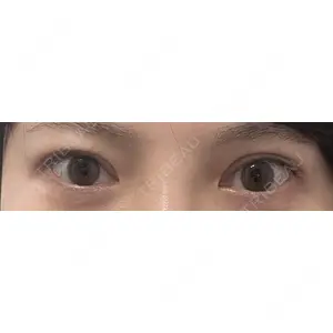 湘南美容クリニック 湘南美容クリニック 上野院口コミ