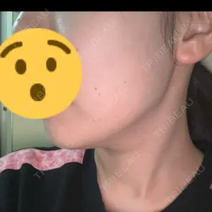 池袋美容クリニック 池袋美容クリニック口コミ