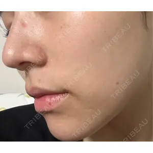 東京素肌クリニック 東京素肌クリニック 銀座本院口コミ