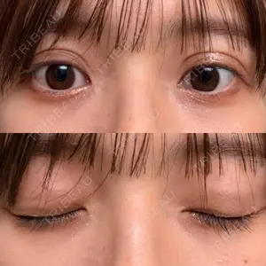 東京イセアクリニック口コミ