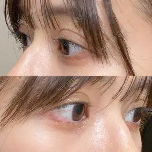 東京イセアクリニック口コミ
