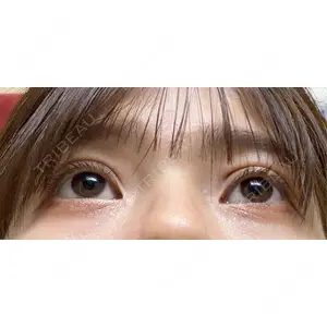 東京イセアクリニック口コミ