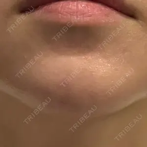 東京美容皮膚科アロエクリニック 東京美容皮膚科アロエクリニック池袋口コミ