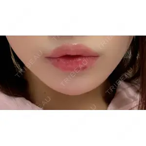 フィラークリニック フィラークリニック 新宿院口コミ