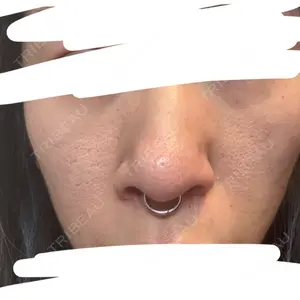 レナータクリニック レナータクリニック 新宿院口コミ