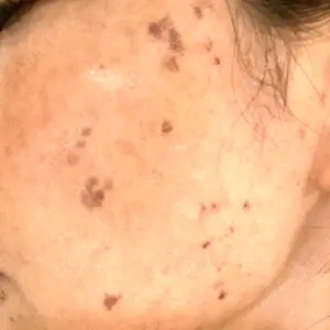 聖心美容クリニック グループ S-Laboクリニック 渋谷院口コミ