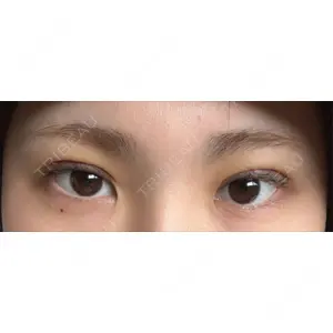 アリエル美容クリニック アリエル美容クリニック 水戸院口コミ