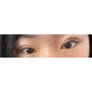 TCB東京中央美容外科 TCB東京中央美容外科 小倉院口コミ