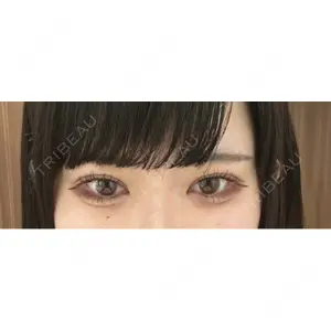 TCB東京中央美容外科 TCB東京中央美容外科 奈良院口コミ