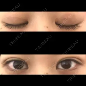 東京シンデレラ美容外科 東京シンデレラ美容外科 大宮院口コミ