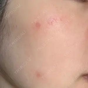 Fellez Clinic【フェルズクリニック】口コミ