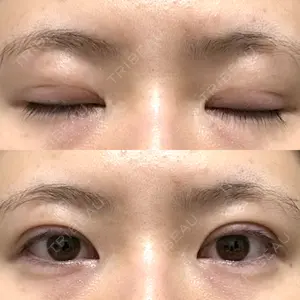 アリエル美容クリニック アリエル美容クリニック 郡山院口コミ