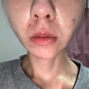 KARIS beauty clinic口コミ