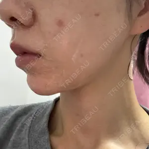 KARIS beauty clinic口コミ