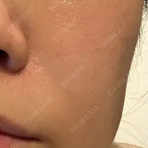 東京美容皮膚科アロエクリニック 東京美容皮膚科アロエクリニック池袋口コミ