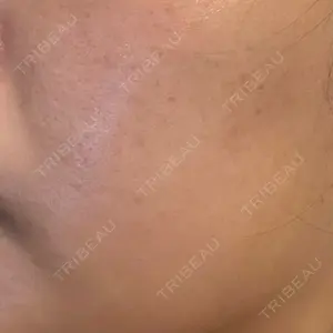 東京美容皮膚科アロエクリニック 東京美容皮膚科アロエクリニック池袋口コミ