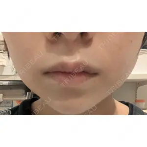 ルラ美容クリニック ルラ美容クリニック 広島院口コミ