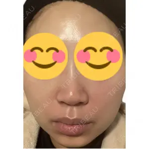 口コミ
