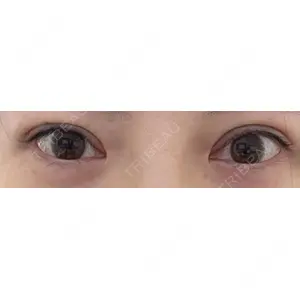 湘南美容クリニック 湘南美容クリニック 上野院口コミ