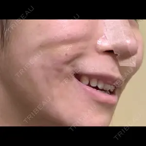 Nebula Clinic 新宿美容外科ネビュラクリニック口コミ