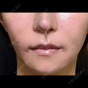 Nebula Clinic 新宿美容外科ネビュラクリニック口コミ