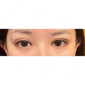 LUHO（ルホ）美容外科口コミ