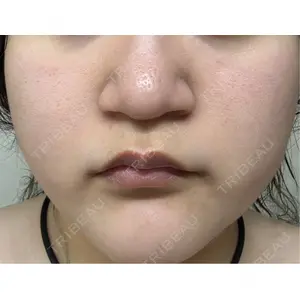 東京美容皮膚科アロエクリニック 東京美容皮膚科アロエクリニック池袋口コミ