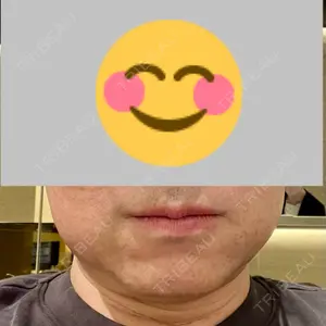 口コミ