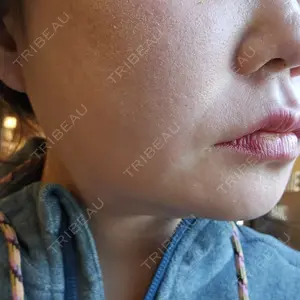 HAAB CLINIC HAAB×DREAM BEAUTY CLINIC 東京本院口コミ