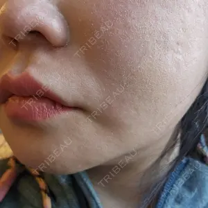 HAAB CLINIC HAAB×DREAM BEAUTY CLINIC 東京本院口コミ