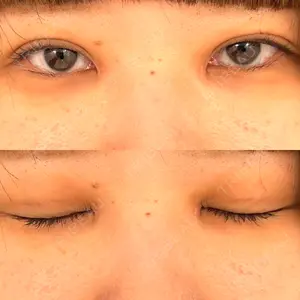 東京シンデレラ美容外科 東京シンデレラ美容外科 池袋院口コミ