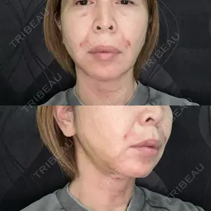 アリエル美容クリニック アリエル美容クリニック 大宮院口コミ