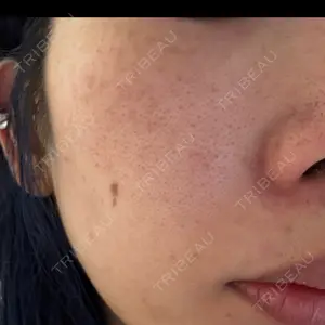 おおたかの森ビューティークリニック おおたかの森ビューティークリニック口コミ