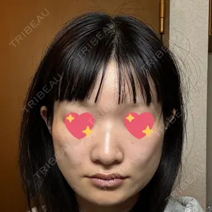 Nebula Clinic 新宿美容外科ネビュラクリニック口コミ