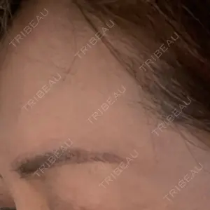 グランジョイクリニック口コミ