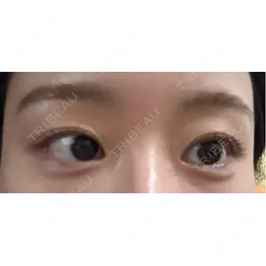 HAAB CLINIC HAAB×DREAM BEAUTY CLINIC 東京本院口コミ