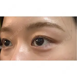 HAAB CLINIC HAAB×DREAM BEAUTY CLINIC 東京本院口コミ