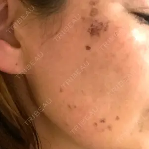 聖心美容クリニック グループ S-Laboクリニック 渋谷院口コミ