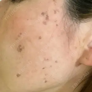 聖心美容クリニック グループ S-Laboクリニック 渋谷院口コミ