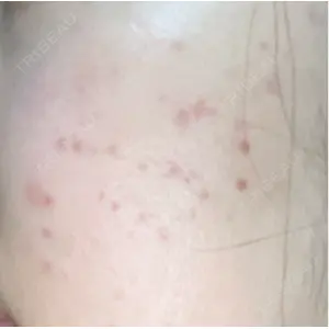 ルラ美容クリニック ルラ美容クリニック 郡山院口コミ