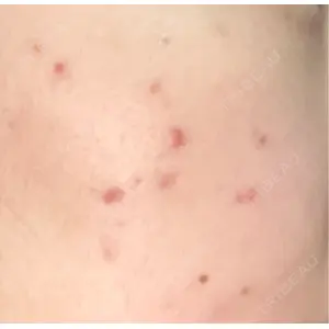 ルラ美容クリニック ルラ美容クリニック 郡山院口コミ