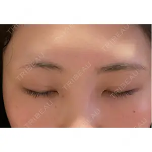 東京イセアクリニック口コミ