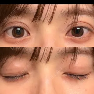 東京イセアクリニック口コミ