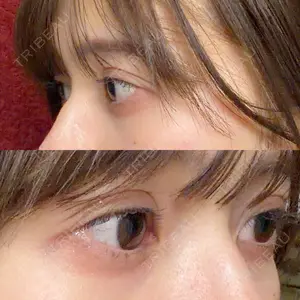 東京イセアクリニック口コミ